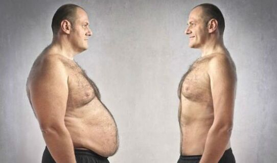 Both men and women want to get rid of a large part of the abdomen